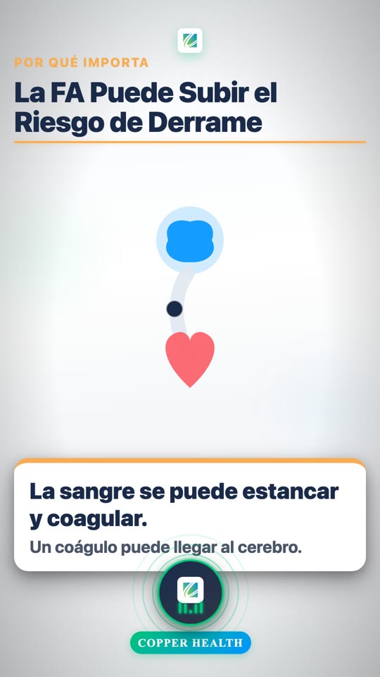 Atrial Fibrillation (AFib) (Spanish)