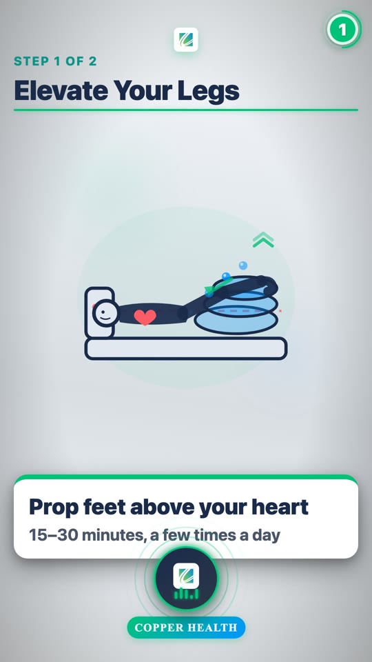 Managing Leg Swelling (Edema)
